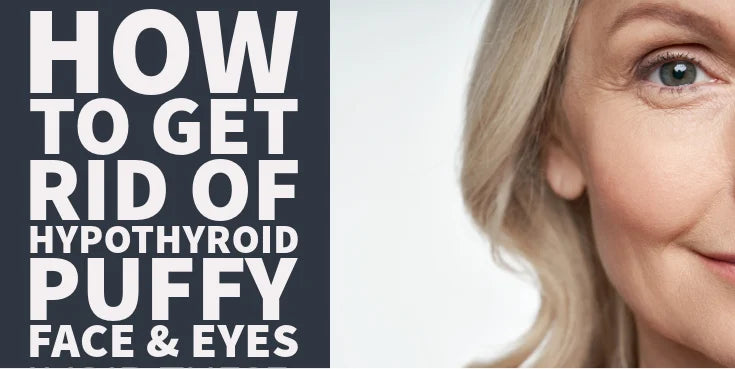 How to Get Rid of Hypothyroid Puffy Face & Eyes